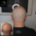 micropigmentation courses copenhagen Scalp Micropigmentation (SMP) | Copenhagen Scalp | Hairloss Solutiion for Men and Women