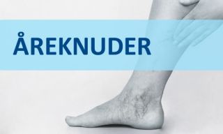  reknuder klinikker k benhavn Dan-Kirurg.dk